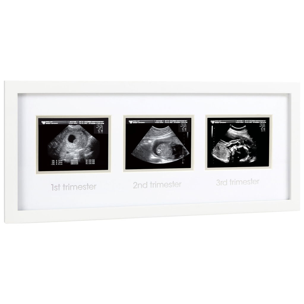 Pearhead Ultraschallbilder Rahmen Schwangerschaftsgeschenk
