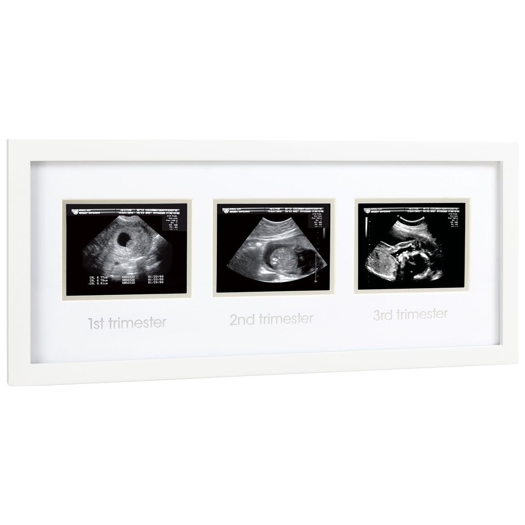 Pearhead Ultrasound Frames